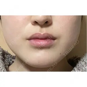 共立美容外科・歯科 共立美容外科 梅田院口コミ