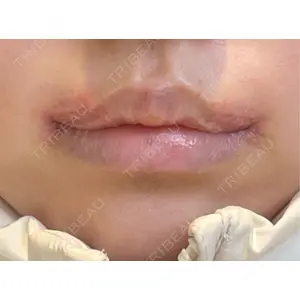 R Beauty CLINIC R Beauty CLINIC 銀座院口コミ