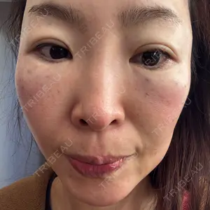 ルラ美容クリニック ルラ美容クリニック 東京駅前院口コミ