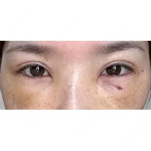 湘南美容クリニック 湘南美容クリニック 千葉センシティ院口コミ