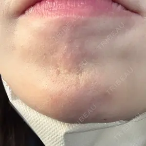 ルラ美容クリニック ルラ美容クリニック 大阪本院口コミ