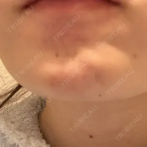 ルラ美容クリニック ルラ美容クリニック 大阪本院口コミ
