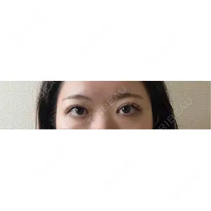 HAAB×DREAM BEAUTY CLINIC HAAB×DREAM BEAUTY CLINIC 東京本院口コミ