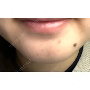 ルラ美容クリニック ルラ美容クリニック 池袋院口コミ