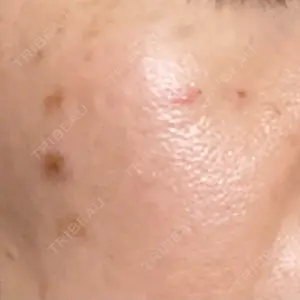 Fellez Clinic【フェルズクリニック】口コミ
