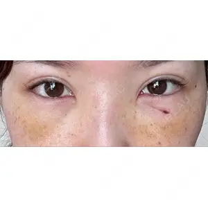 湘南美容クリニック 湘南美容クリニック 千葉センシティ院口コミ