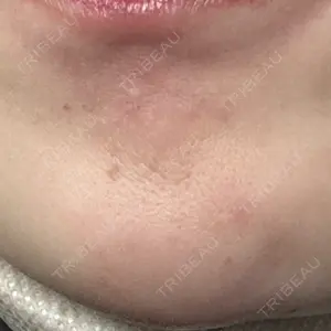 ルラ美容クリニック ルラ美容クリニック 大阪本院口コミ
