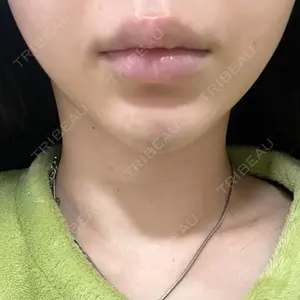 口コミ