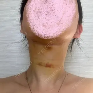 くさのたろうクリニック口コミ