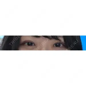 LUHO（ルホ）美容外科口コミ
