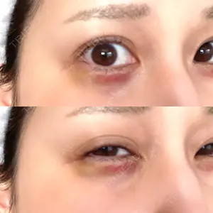 HAAB×DREAM BEAUTY CLINIC HAAB×DREAM BEAUTY CLINIC 東京本院口コミ