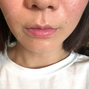 L‘amour clinic Tokyo【ラムールクリニック東京】口コミ