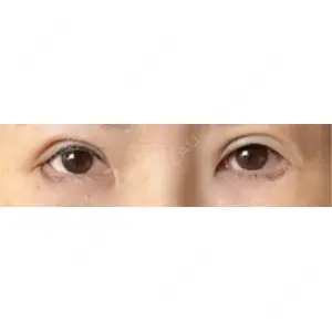 HAAB×DREAM BEAUTY CLINIC HAAB×DREAM BEAUTY CLINIC 大阪梅田院口コミ