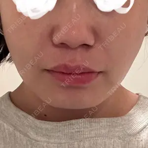 口コミ