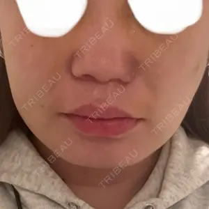 口コミ