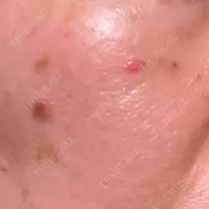 Fellez Clinic【フェルズクリニック】口コミ