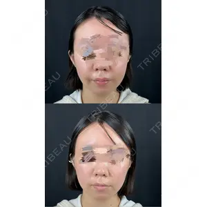 ルラ美容クリニック ルラ美容クリニック 新宿院口コミ