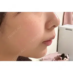 HAAB×DREAM BEAUTY CLINIC HAAB×DREAM BEAUTY CLINIC 東京本院口コミ
