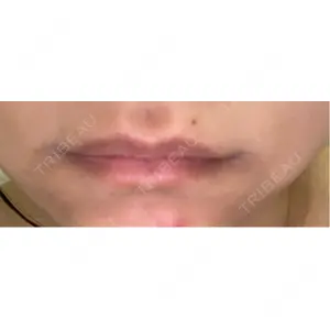 新未来クリニック口コミ