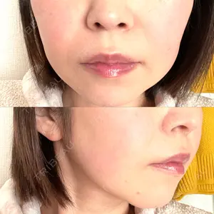 椿クリニック 銀座TSUBAKIクリニック口コミ