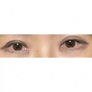 HAAB×DREAM BEAUTY CLINIC HAAB×DREAM BEAUTY CLINIC 大阪梅田院口コミ