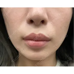 A CLINIC（エークリニック） 横浜院口コミ