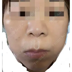 口コミ