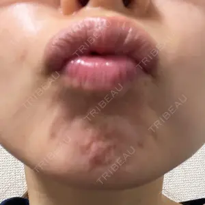 ビューティースキンクリニック ビューティースキンクリニック 新宿院口コミ