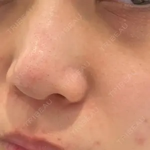 DAILY SKIN CLINIC DAILY SKIN CLINIC 心斎橋院口コミ