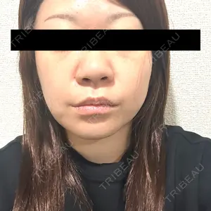 HAAB×DREAM BEAUTY CLINIC HAAB×DREAM BEAUTY CLINIC 東京本院口コミ