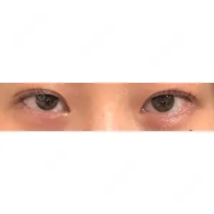 東京シンデレラ美容外科 東京シンデレラ美容外科 池袋院口コミ
