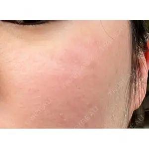 アマリラビューティークリニック口コミ