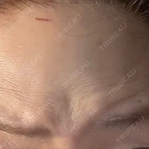 湘南美容クリニック 湘南美容クリニック 大阪梅田本院口コミ