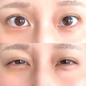 HAAB×DREAM BEAUTY CLINIC HAAB×DREAM BEAUTY CLINIC 東京本院口コミ