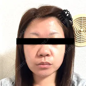 HAAB×DREAM BEAUTY CLINIC HAAB×DREAM BEAUTY CLINIC 東京本院口コミ