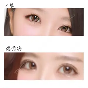 大塚美容形成外科 大塚美容形成外科 横浜院口コミ