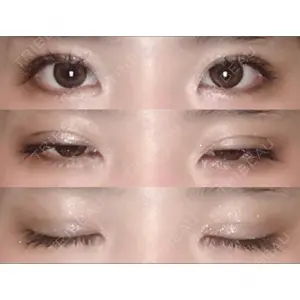 大塚美容形成外科 大塚美容形成外科 横浜院口コミ