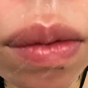 BiBiクリニック口コミ