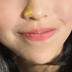 口コミ
