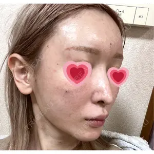 銀座マイアミ美容外科口コミ