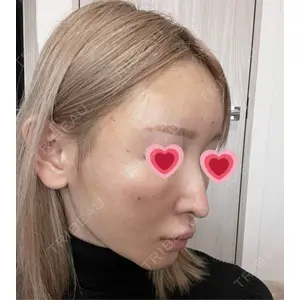銀座マイアミ美容外科口コミ