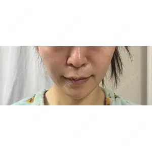 口コミ