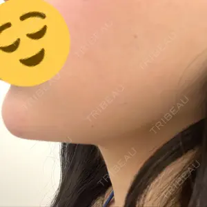 TCB東京中央美容外科 TCB東京中央美容外科 宇都宮院口コミ