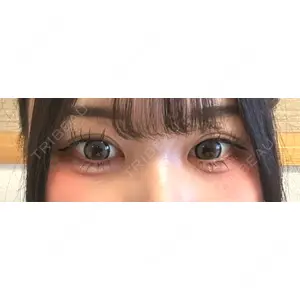HAAB×DREAM BEAUTY CLINIC HAAB×DREAM BEAUTY CLINIC 東京本院口コミ