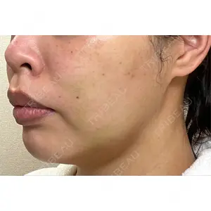 藤・ナチュレ美容クリニック 藤・ナチュレ美容クリニック 銀座院口コミ
