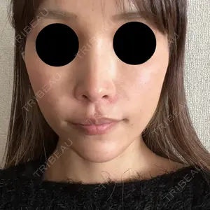 口コミ