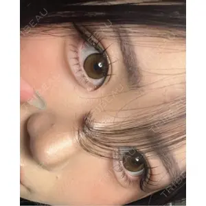 LUHO（ルホ）美容外科口コミ