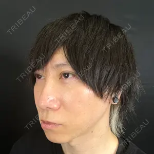 藤・ナチュレ美容クリニック 藤・ナチュレ美容クリニック 銀座院口コミ