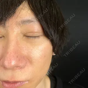 藤・ナチュレ美容クリニック 藤・ナチュレ美容クリニック 銀座院口コミ
