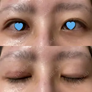 いちのせ形成外科・皮膚科 眼瞼＆フェイスクリニック口コミ